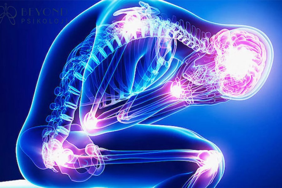 Psikosomatik Ağrılar Nedir?